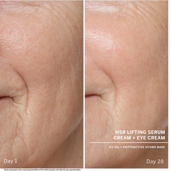 HSR Lifting Serum