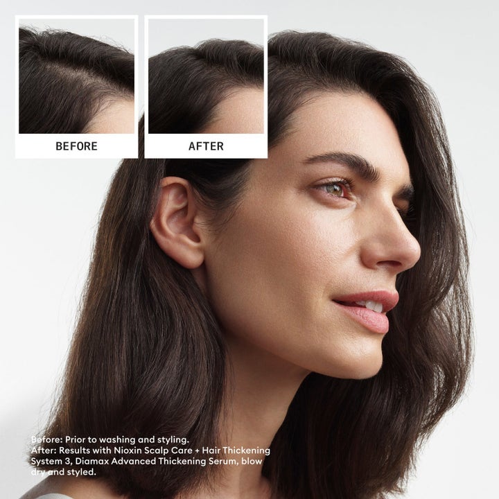 Scalp Care & Strengthening Set
