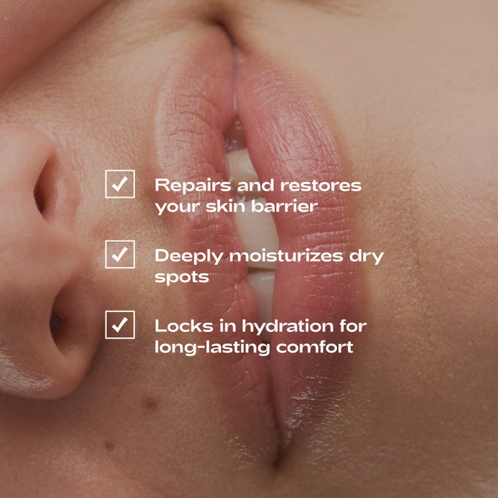 Beyond Balm Intense Repairing Lip & Skin Balm