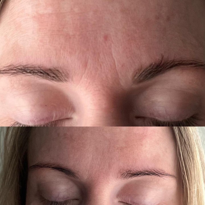 Facial Beauty Tape
