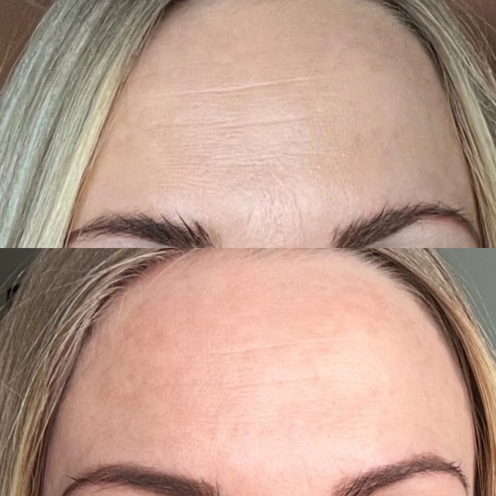 Facial Beauty Tape